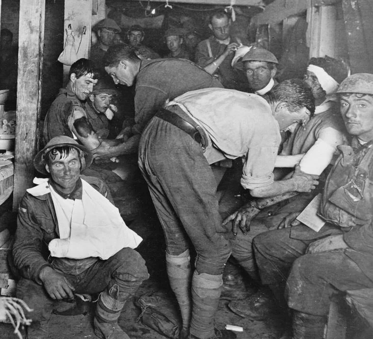 A World War 1 soldier exhibiting the thousand-yard stare characteristic of shell shock, now known as PTSD